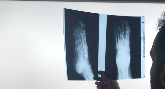 x-Ray Image 01