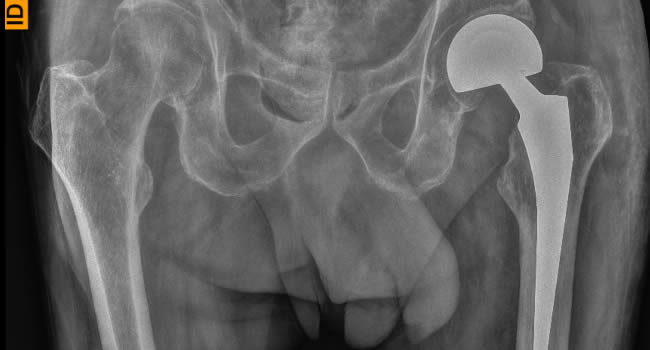 x-Ray Image 02