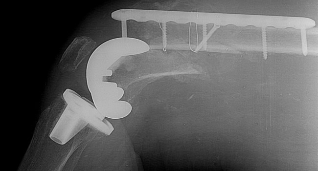 x-Ray Image 05