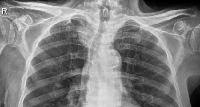 x-Ray Image 03