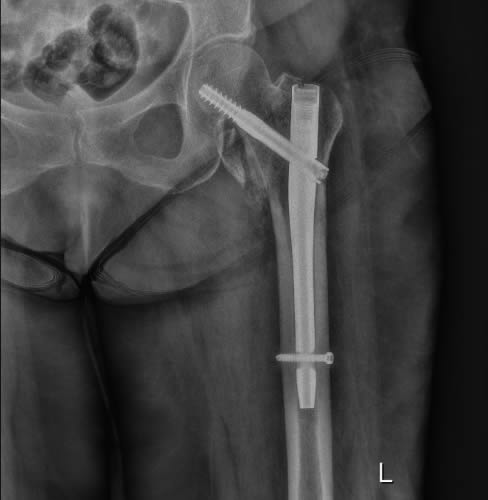 x-Ray Image 05