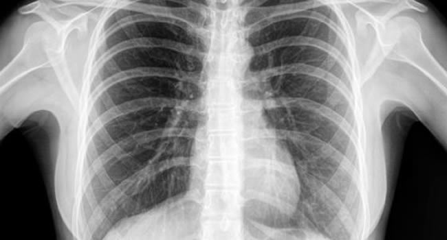 x-Ray Image 06