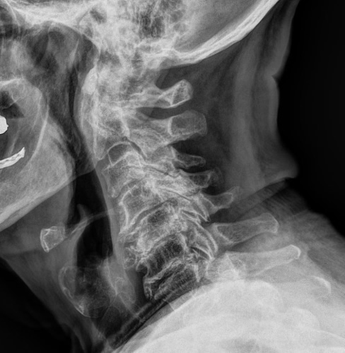 x-Ray Image 02