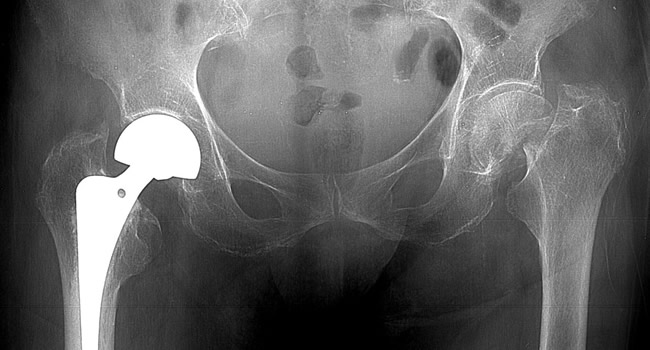 x-Ray Image 04