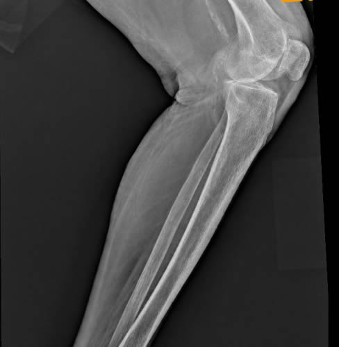 x-Ray Image 02