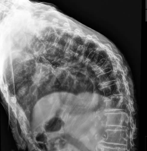 x-Ray Image 02